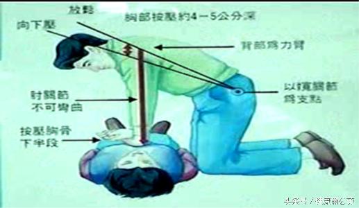 小儿心肺复苏最新标准解析